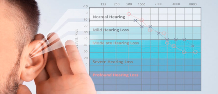 Audiometria para empresas